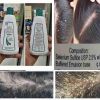 Selenium Sulfide Topical Suspension USP Shampoo