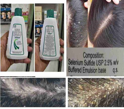 Selenium Sulfide Topical Suspension USP Shampoo